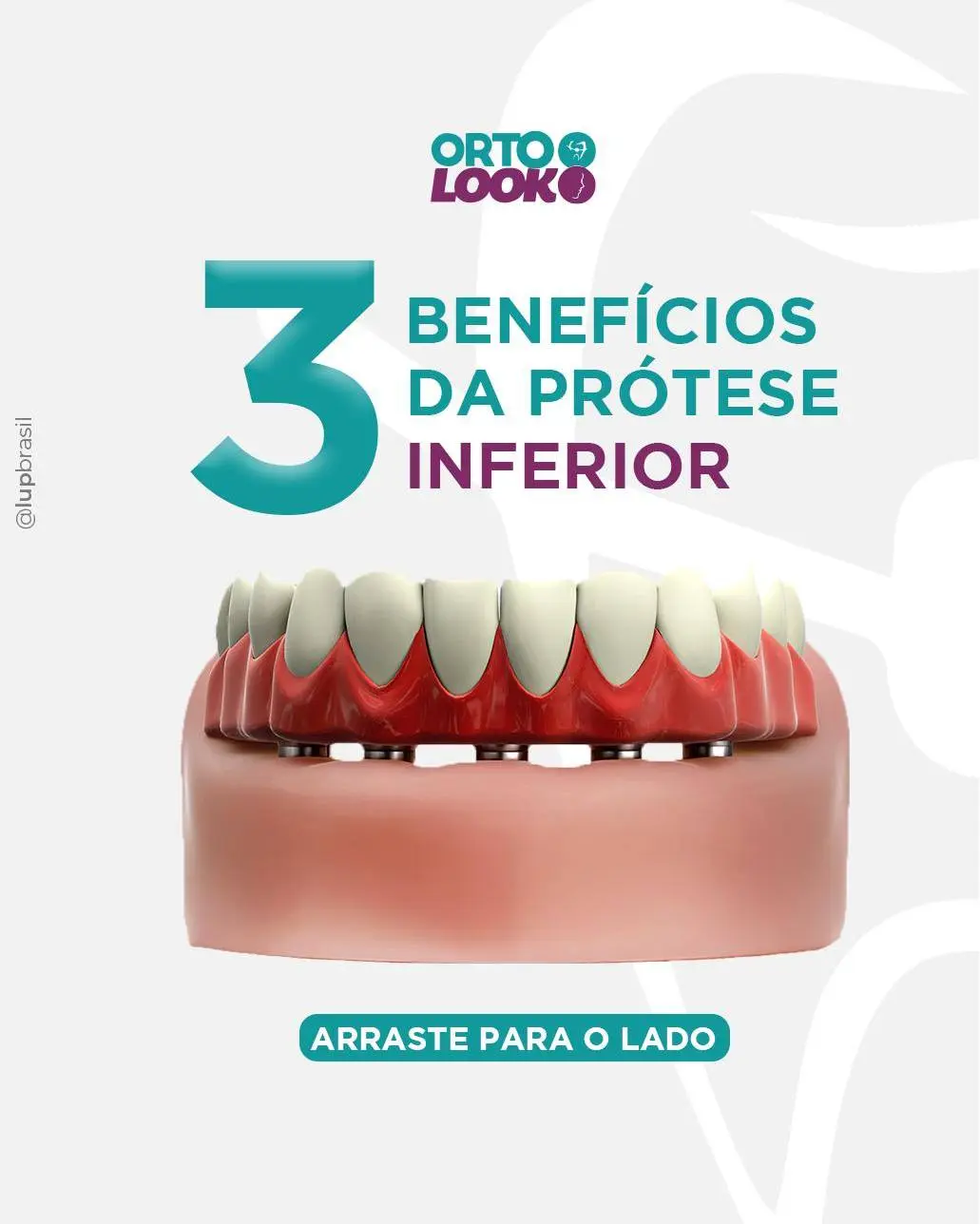 Antes e depois de tratamento odontológico 4 na Ortolook